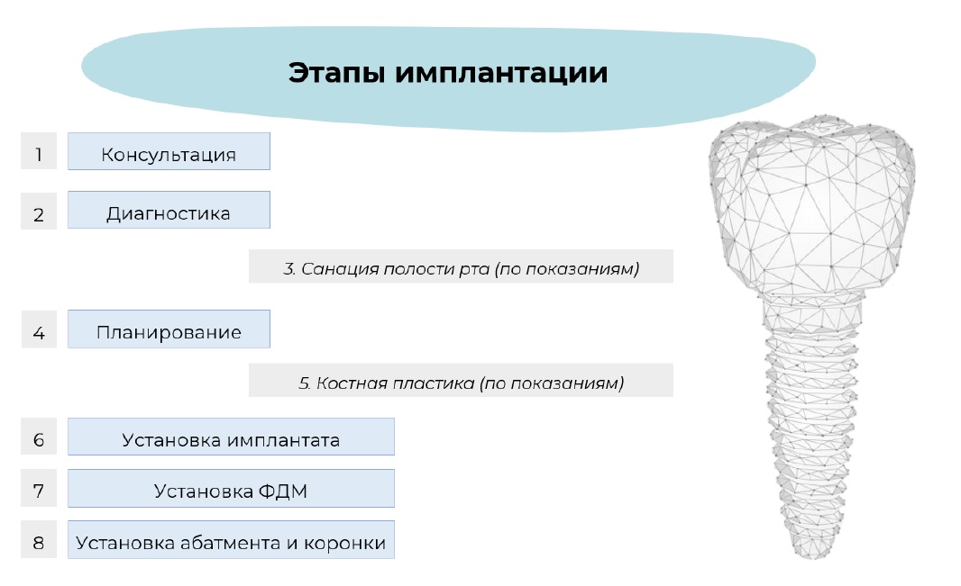 этапы имплантации