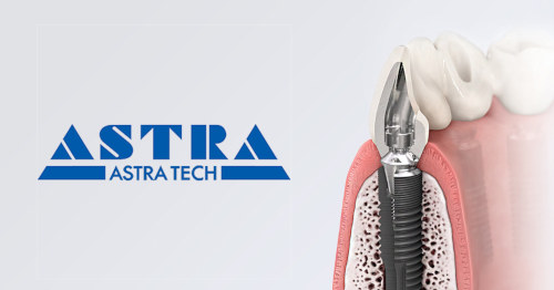 Импланты Astra Tech Томск Водяной 1-й Лечение молочных зубов Томск Кабельный